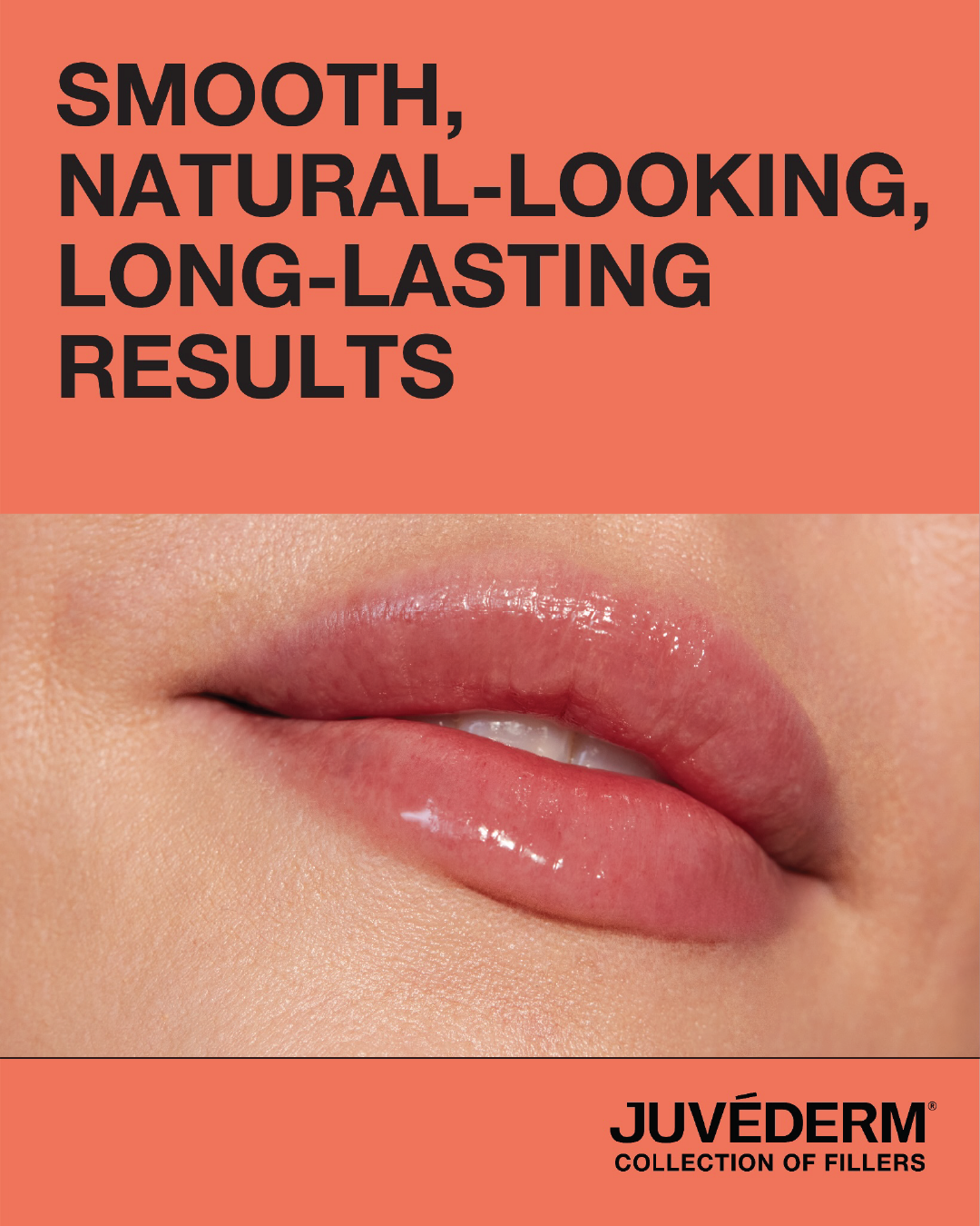 botox before + after